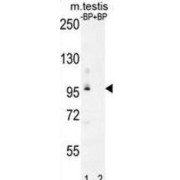 Western blot analysis of PDPR Antibody (C-term) pre-incubated without (Lane 1) and with (Lane 2) blocking peptide in mouse testis tissue lysate. PDPR Antibody (C-term) was detected using the purified Pab.