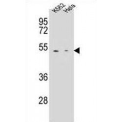 Carboxypeptidase B1, Tissue (CPB1) Antibody