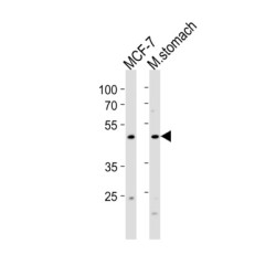 Forkhead Box Protein A2 (FOXA2) Antibody