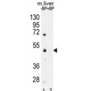 Sphingomyelin Synthase-Related Protein 1 (SAMD8) Antibody