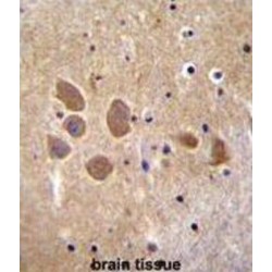 AP-1 Complex Subunit Mu-1 (AP1M1) Antibody