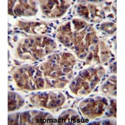 Growth Differentiation Factor 5 (GDF5) Antibody