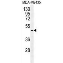 Growth Differentiation Factor 5 (GDF5) Antibody