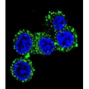 Calcium Channel, Voltage Dependent, Gamma Subunit 6 (CACNG6) Antibody