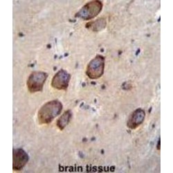 Calcium Channel, Voltage Dependent, Gamma Subunit 6 (CACNG6) Antibody