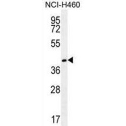 Gamma-Glutamyl Hydrolase (GGH) Antibody