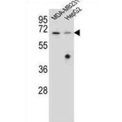 Glomulin (GLMN) Antibody