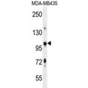 Tripartite Motif-Containing 33 (TRIM33) Antibody