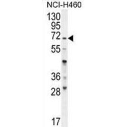 Alpha-(1,3)-Fucosyltransferase 4 (FUT4) Antibody