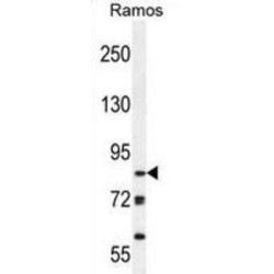 JmjC Domain-Containing Histone Demethylation Protein 2B (JHDM2b) Antibody