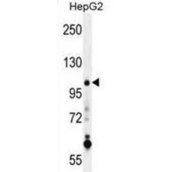 Suppressor of Variegation 4-20 Homolog 1 (SUV4-20H1) Antibody