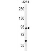 Histone Acetyltransferase KAT2B (PCAF) Antibody