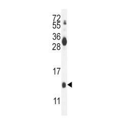 Midkine (MDK) Antibody