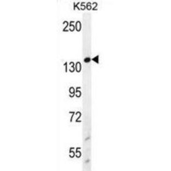 Bifunctional 3'-5' Exonuclease/ATP-Dependent Helicase WRN (WRN) Antibody