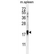 Zinc Finger Protein 593 (ZNF593) Antibody