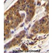 Complement Factor D (CFD) Antibody