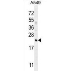 Complement Factor D (CFD) Antibody