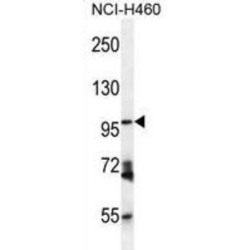 Glutamyl Aminopeptidase (Aminopeptidase A) (ENPEP) Antibody