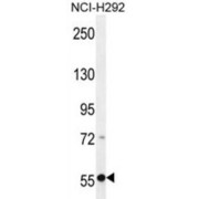 RAD26 Antibody