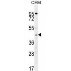 Zinc Finger MYND Domain-Containing Protein 10 (ZMYND10) Antibody