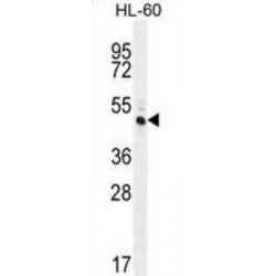 Ras And Rab Interactor-Like Protein (RINL) Antibody