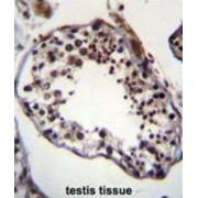 Tripartite Motif Containing 69 (TRIM69) Antibody