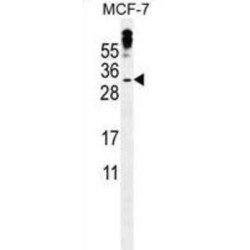 Putative Methyl-CpG-Binding Domain Protein 3-Like 3 (MBD3L3) Antibody