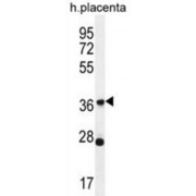 Olfactory Receptor Family 4 Subfamily L Member 1 (OR4L1) Antibody