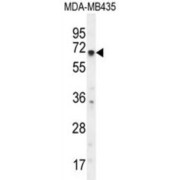 Potassium Voltage-Gated Channel Subfamily Q Member 1 (KCNQ1) Antibody