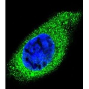 Collagen Type XXI Alpha 1 (COL21A1) Antibody