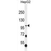 WB analysis of HepG2 cell line lysates.