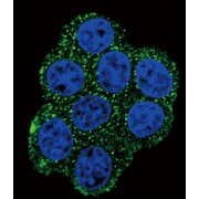 Succinate Dehydrogenase Complex Subunit D (SDHD) Antibody