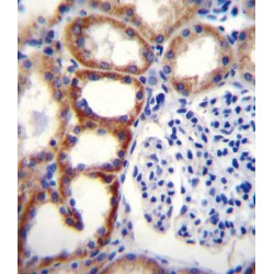 Succinate Dehydrogenase Complex Subunit D (SDHD) Antibody