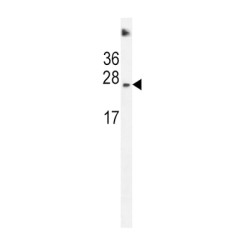 Succinate Dehydrogenase Complex Subunit D (SDHD) Antibody