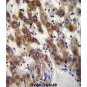 PHD Finger Protein 20 (PHF20) Antibody