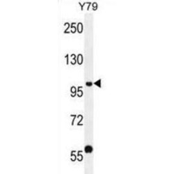 PHD Finger Protein 20 (PHF20) Antibody