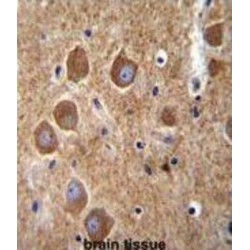 P21 Activated Kinase 6 (PAK6) Antibody