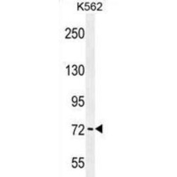 P21 Activated Kinase 6 (PAK6) Antibody