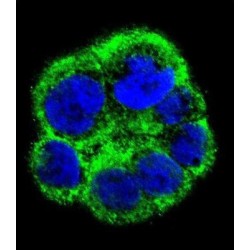 Choline-Phosphate Cytidylyltransferase A (PCYT1A) Antibody