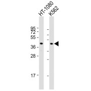 WB analysis of Ht-1080 and K562 whole cell lysates, using PCYT1A antibody (1/1000 dilution).