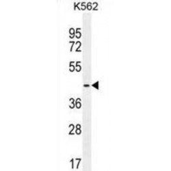 TATA-Box Binding Protein Like 2 (TBPL2) Antibody