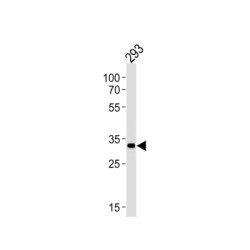 STIP1 Homology And U-Box Containing Protein 1 (STUB1) Antibody