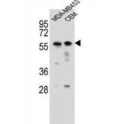 Forkhead Box Protein D4 (FOXD4) Antibody