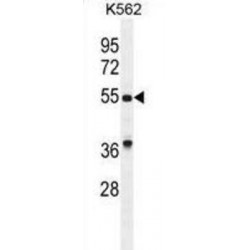 Growth Differentiation Factor 9 (GDF9) Antibody