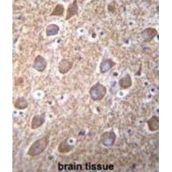 RAS Guanyl Nucleotide-Releasing Protein 2 (RASGRP2) Antibody