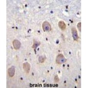 Potassium Two Pore Domain Channel Subfamily K Member 1 (KCNK1) Antibody