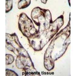 Pygopus Homolog 1 (PYGO1) Antibody