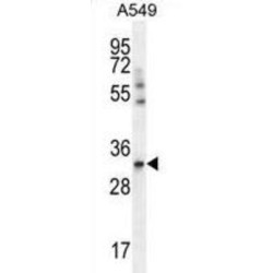 ADP/ATP Translocase 3 (SLC25A6) Antibody