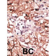 Lysine-Specific Histone Demethylase 1A (LSD1) Antibody