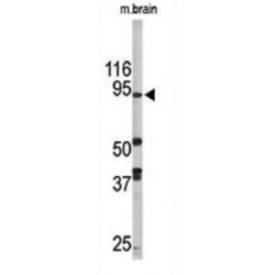 Lysine-Specific Histone Demethylase 1A (LSD1) Antibody